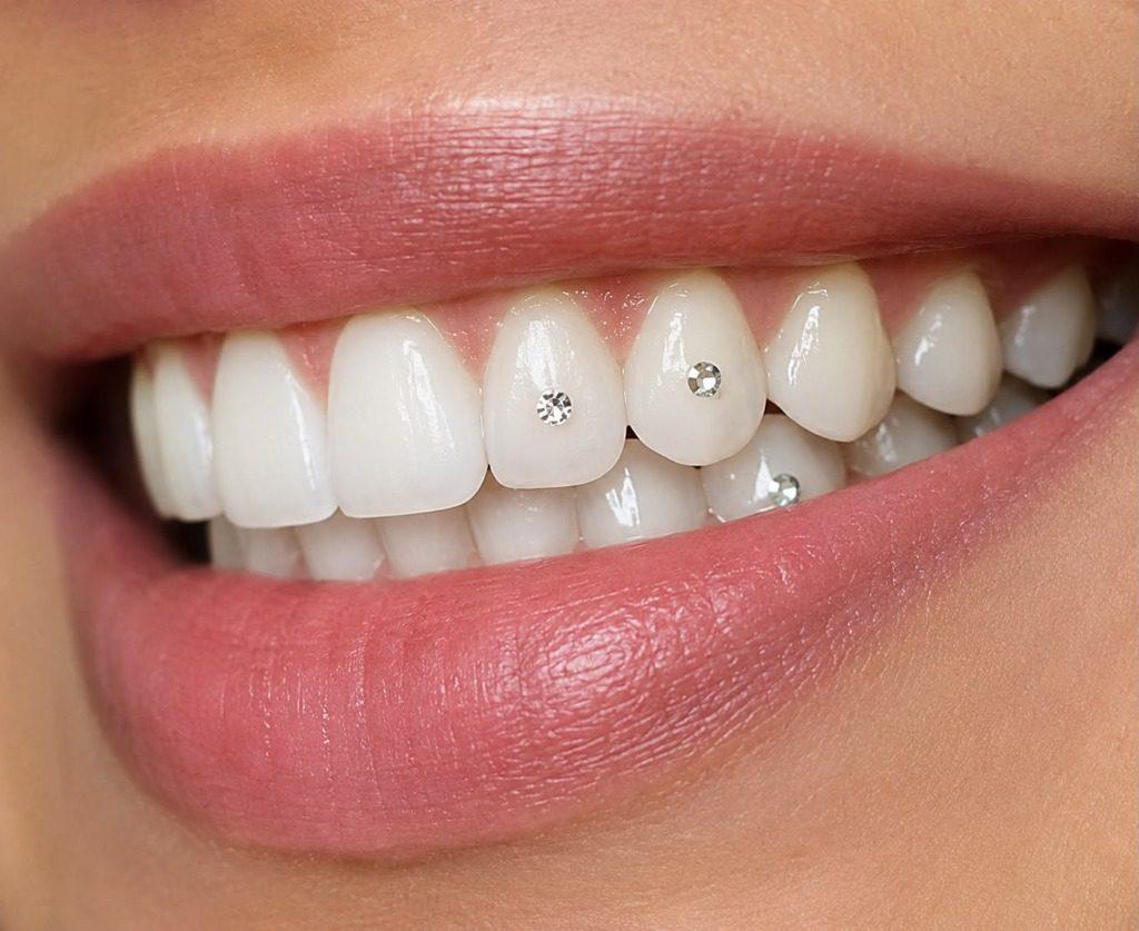 Multi Crystal Tooth Gem Aesthetic Styling in Rourkela ( Raurkela )