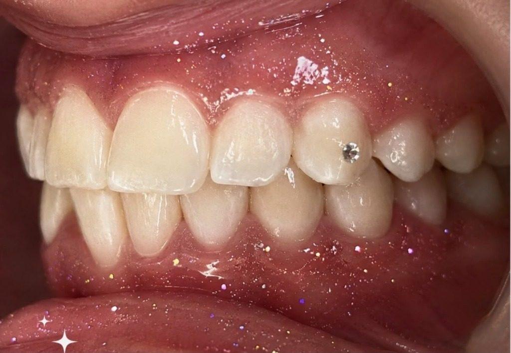 Tooth Gem Diamond Cosmetic Crystal